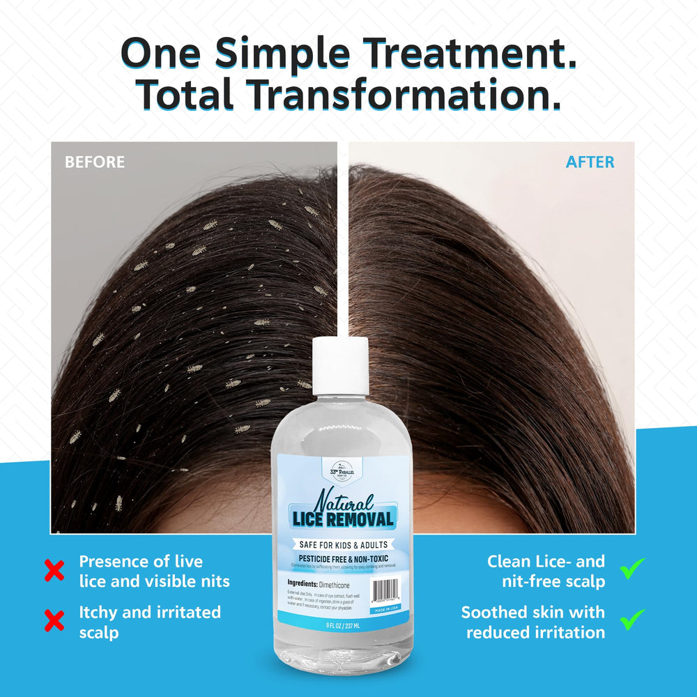 33RD PARALLEL SOAP CO Safe Lice Shampoo applying to scalp shows easy treatment.
