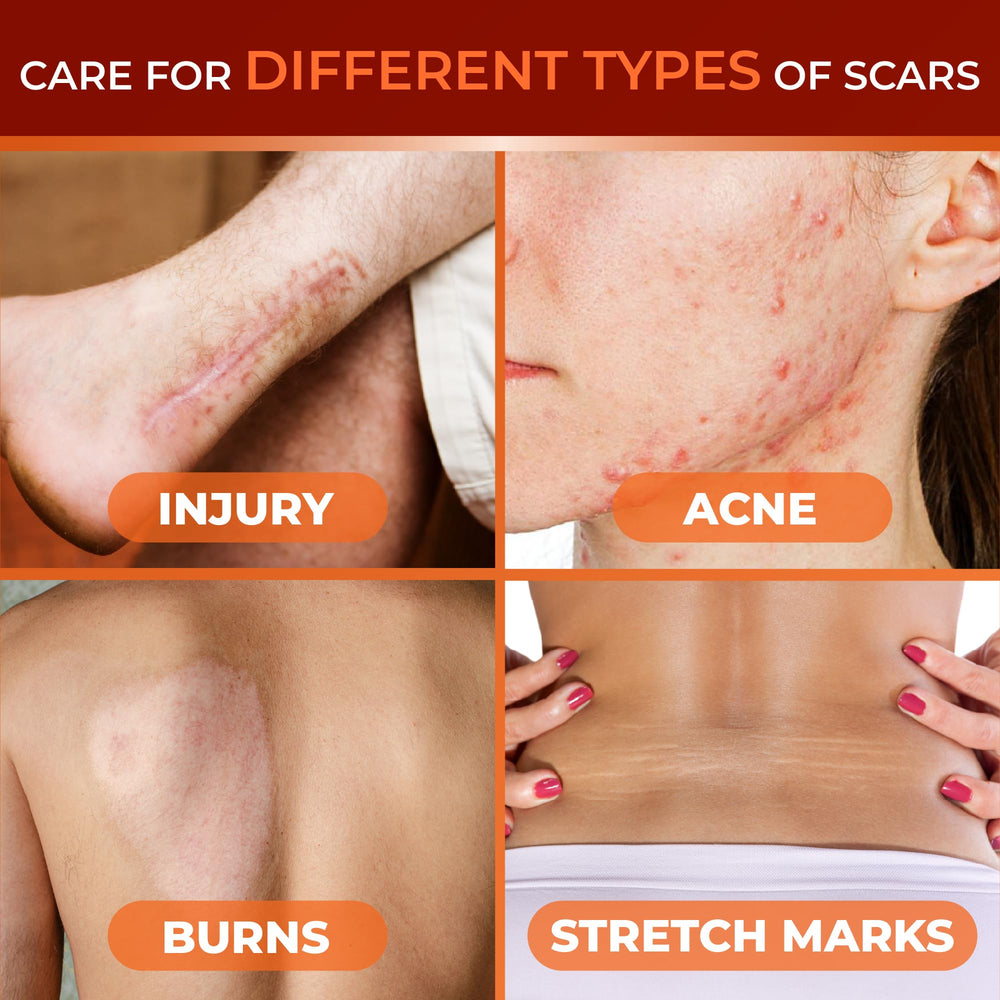 ABERA Scar Cream application scene demonstrates gentle massage.