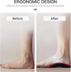 Aimesole orthotics insole, bottom view, durable gel core supports lasting shock absorption.