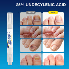 AntiFung 3-pack box image shows travel-friendly kit for consistent nail care.