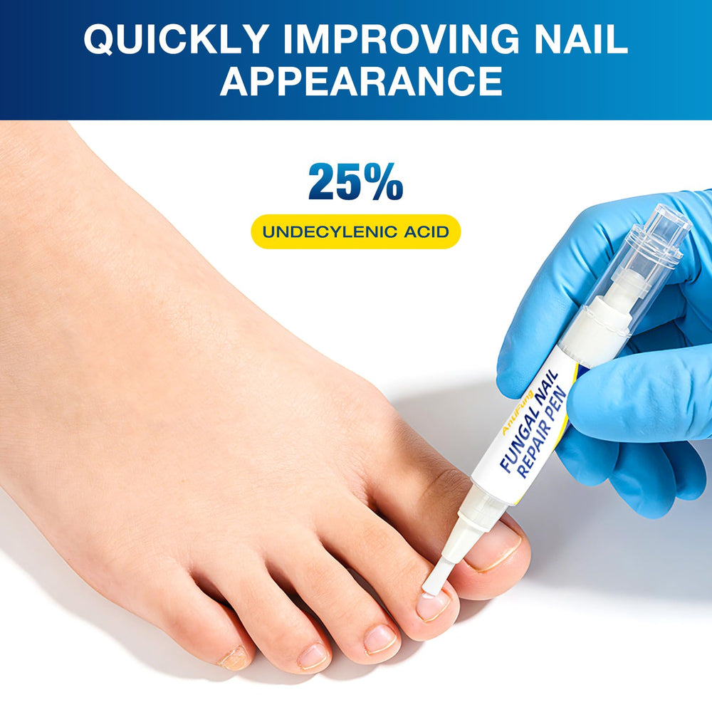 AntiFung Toenail Pen application tip highlights precise, on-the-go care for affected nails.