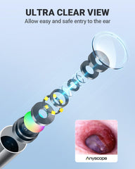 AnyScope HD Otoscope split-screen view comparing live and saved images