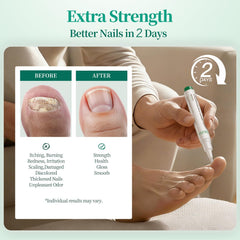 APUREE Night Pen overnight renewal nourishes nails while you sleep.