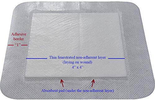 Areza Medical easy-tear packaging enables quick, clean application
