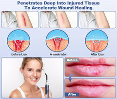 Aswaysun infrared wand with tips attached for versatile facial and body therapy.