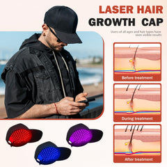 Close-up of 650nm laser diodes on the Auarwood cap for scalp phototherapy.