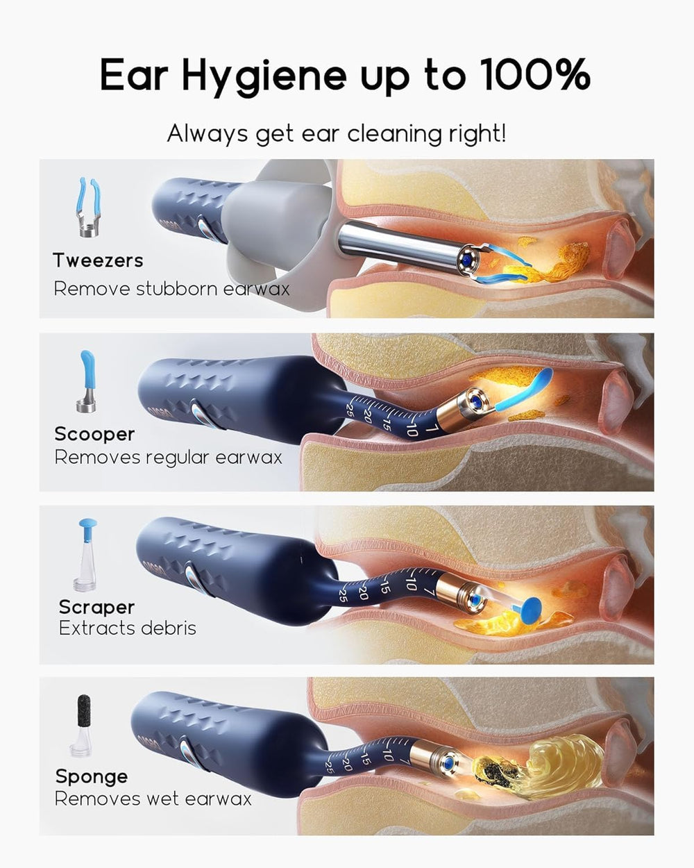 BEBIRD Earsight Plus home endoscope for at‑home ear monitoring and sharing visuals.