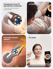 BEBIRD Earsight Plus spiral cleaning head remains securely fixed during use.