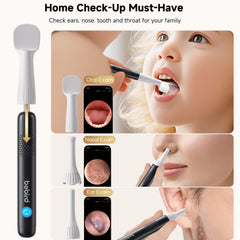 BEBIRD R1 Ultra camera view sharing lets you show findings to your doctor.