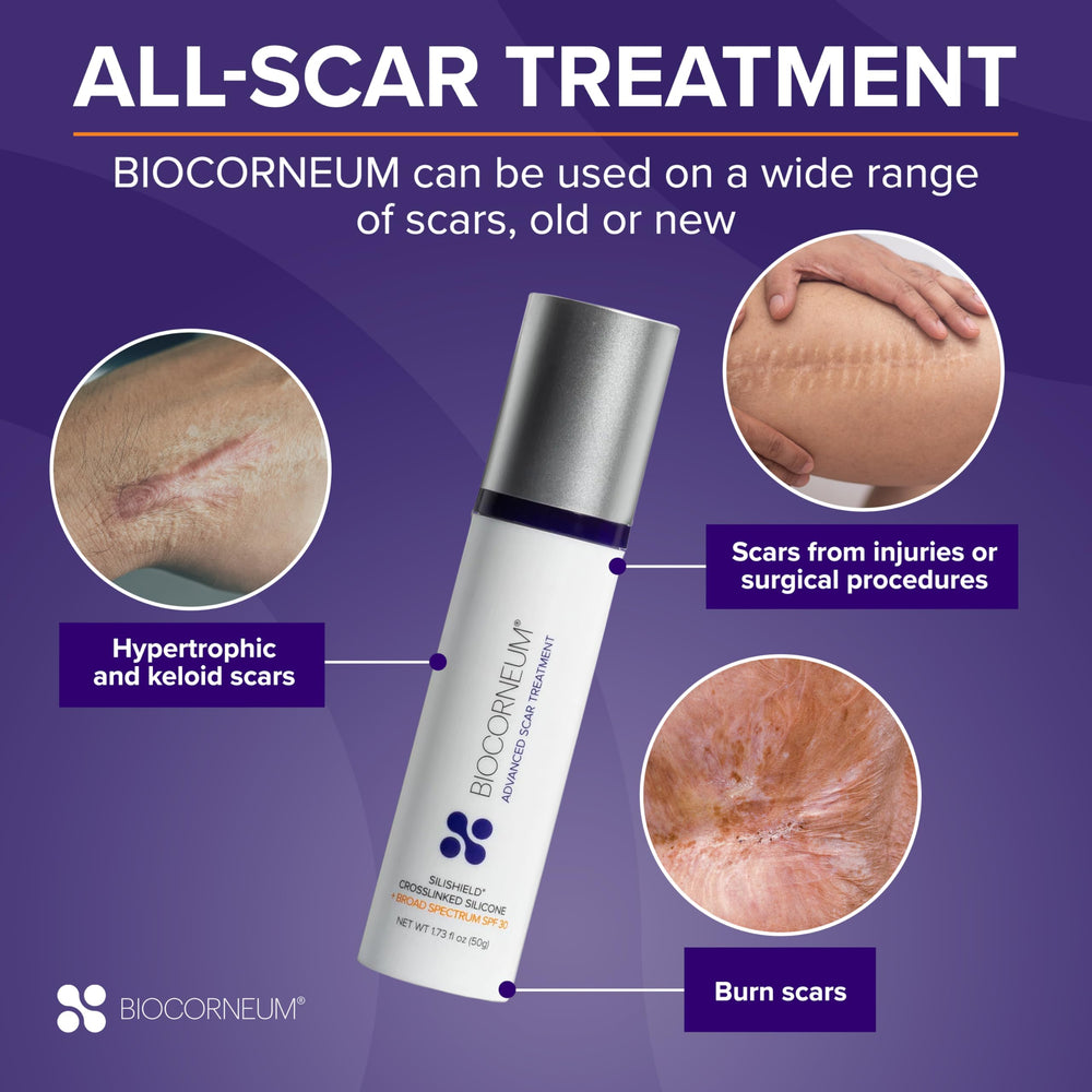 BIOCORNEUM packaging box displaying advanced scar treatment branding.