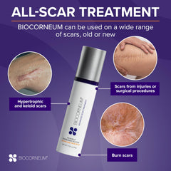 BIOCORNEUM packaging box displaying advanced scar treatment branding.