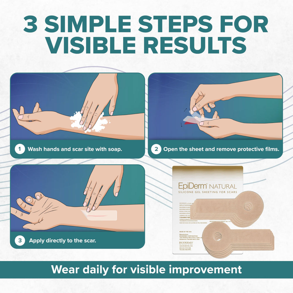 BIODERMIS EpiDerm Areopexy discreet under clothing for daily use.