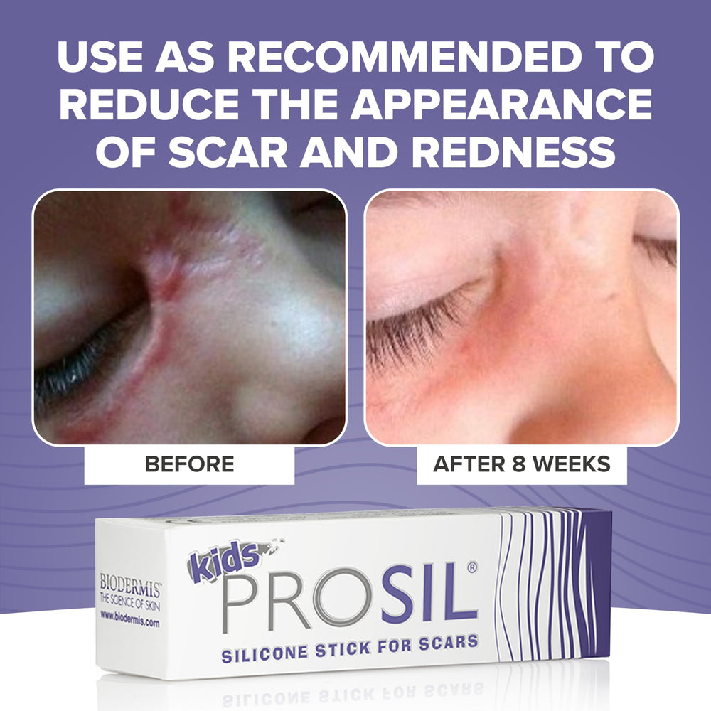 BIODERMIS Pro-Sil Kids ideal for exposed areas like face.