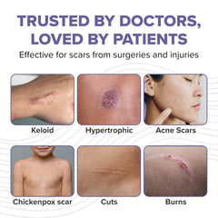 BIODERMIS Pro-Sil Kids travel-size care for busy families.