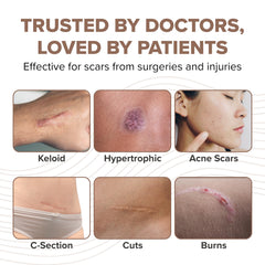 BIODERMIS ProSil glide-on stick enables precise application