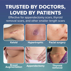 Split-liner design enables fast, clean application of the scar patches.