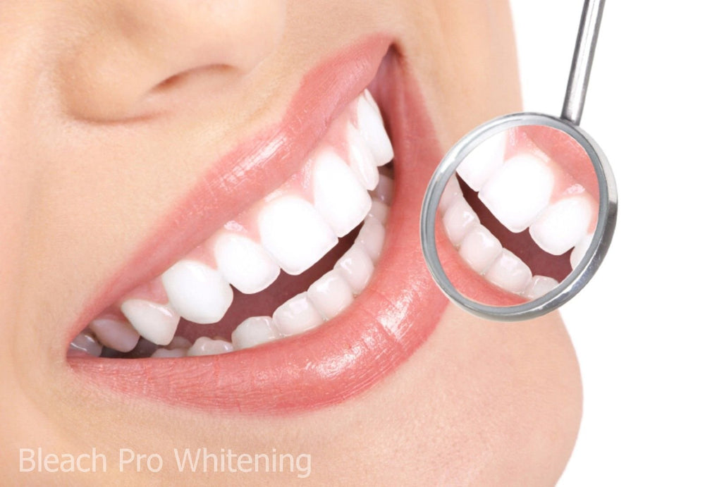 Smiling face after using Bleach Pro whitening gel