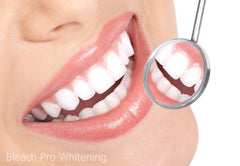 Smiling face after using Bleach Pro whitening gel