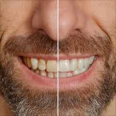 Bright White Smiles before-and-after swatches illustrate visible whitening progress over time.