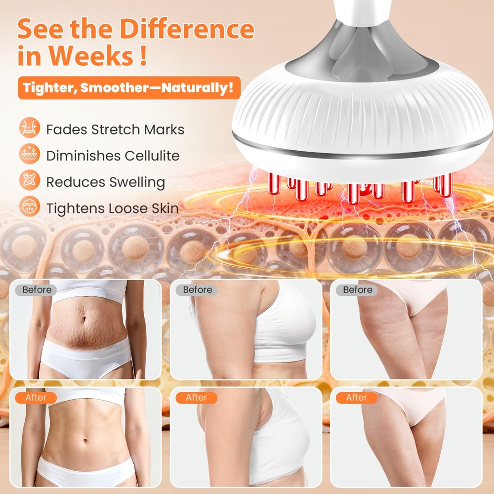 Choufaly device used with lotion or conductive gel for improved glide and conductivity.
