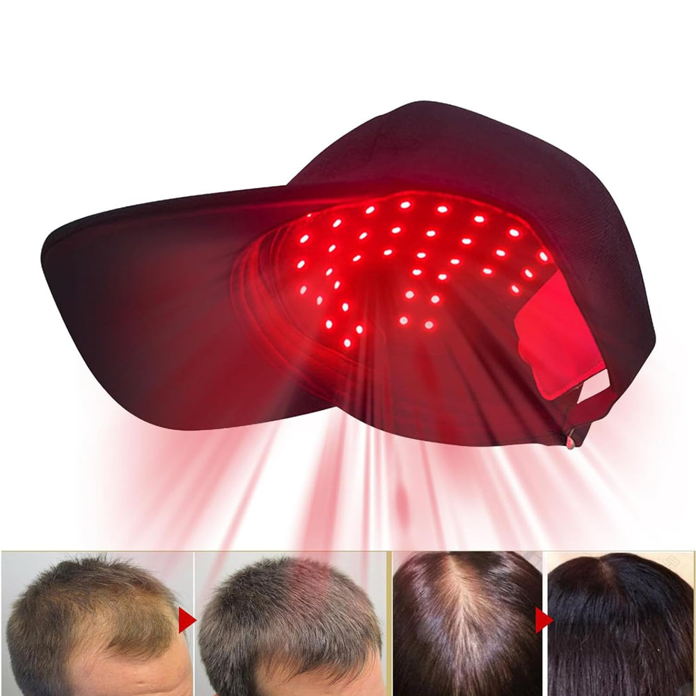 Close-up of Cilate LLLT cap laser module for targeted scalp therapy.