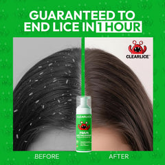 Clearlice foam close-up showing natural formula for family use