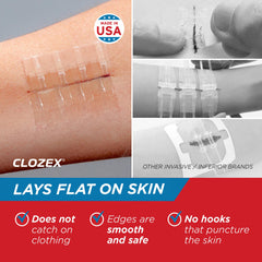 Clozex cover bandages protect the closed wound after use.