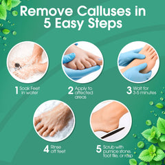 DeEnti Callus Remover feet application demonstrates targeted treatment for cracked heels.