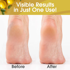 Home pedicure setup with DeEnti foot care for dry skin.