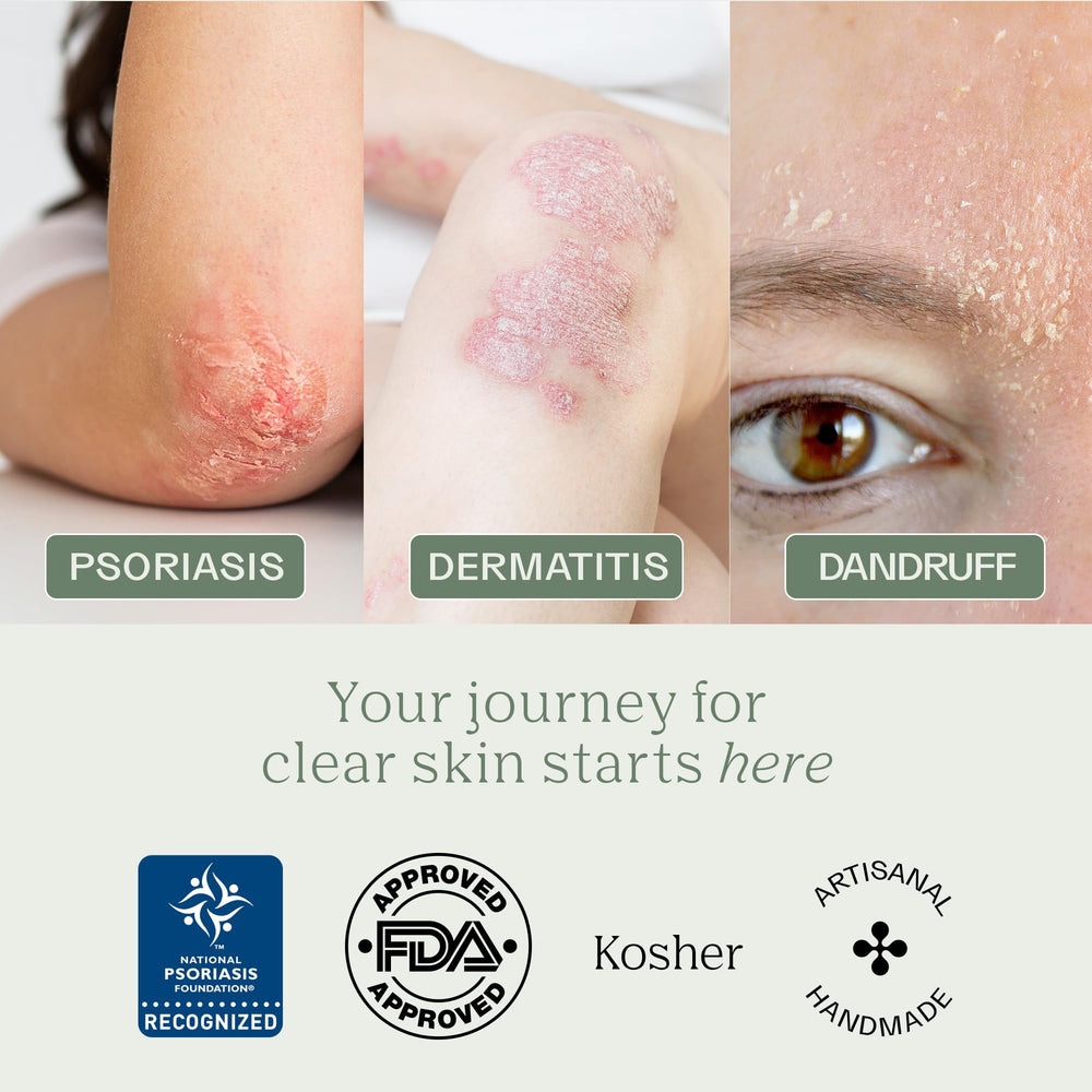 Dermabon 3-bar pack, individually sealed, convenient care for psoriasis and eczema