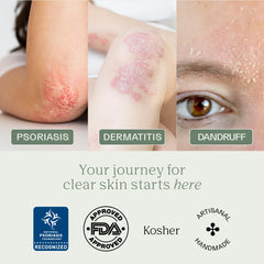 Dermabon 3-bar pack, individually sealed, convenient care for psoriasis and eczema