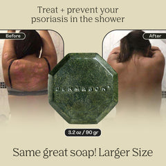 Dermabon hydrating bar moisturizes dry skin and helps restore moisture