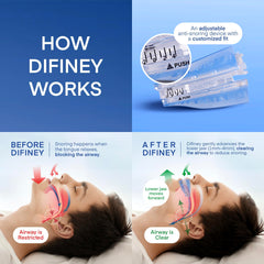 Difiney Anti Snoring Device jaw-repositioning helps open airways for quieter sleep.