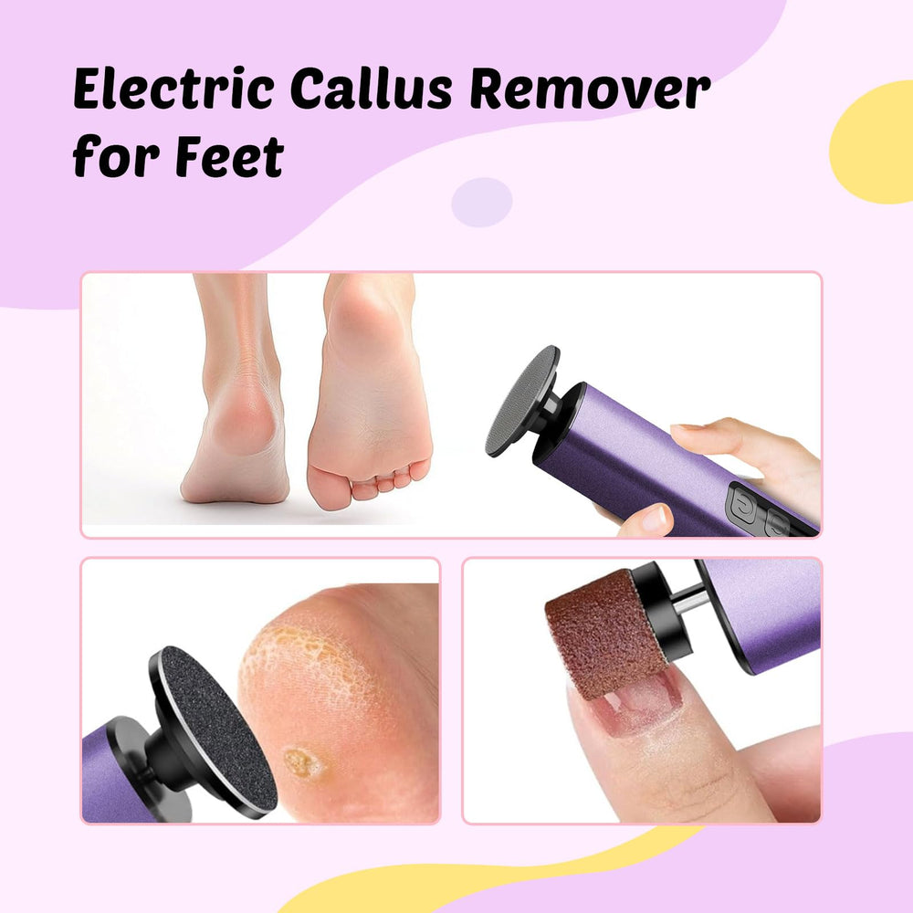 Dolcevitae flat grinding head covers more surface area for faster exfoliation.
