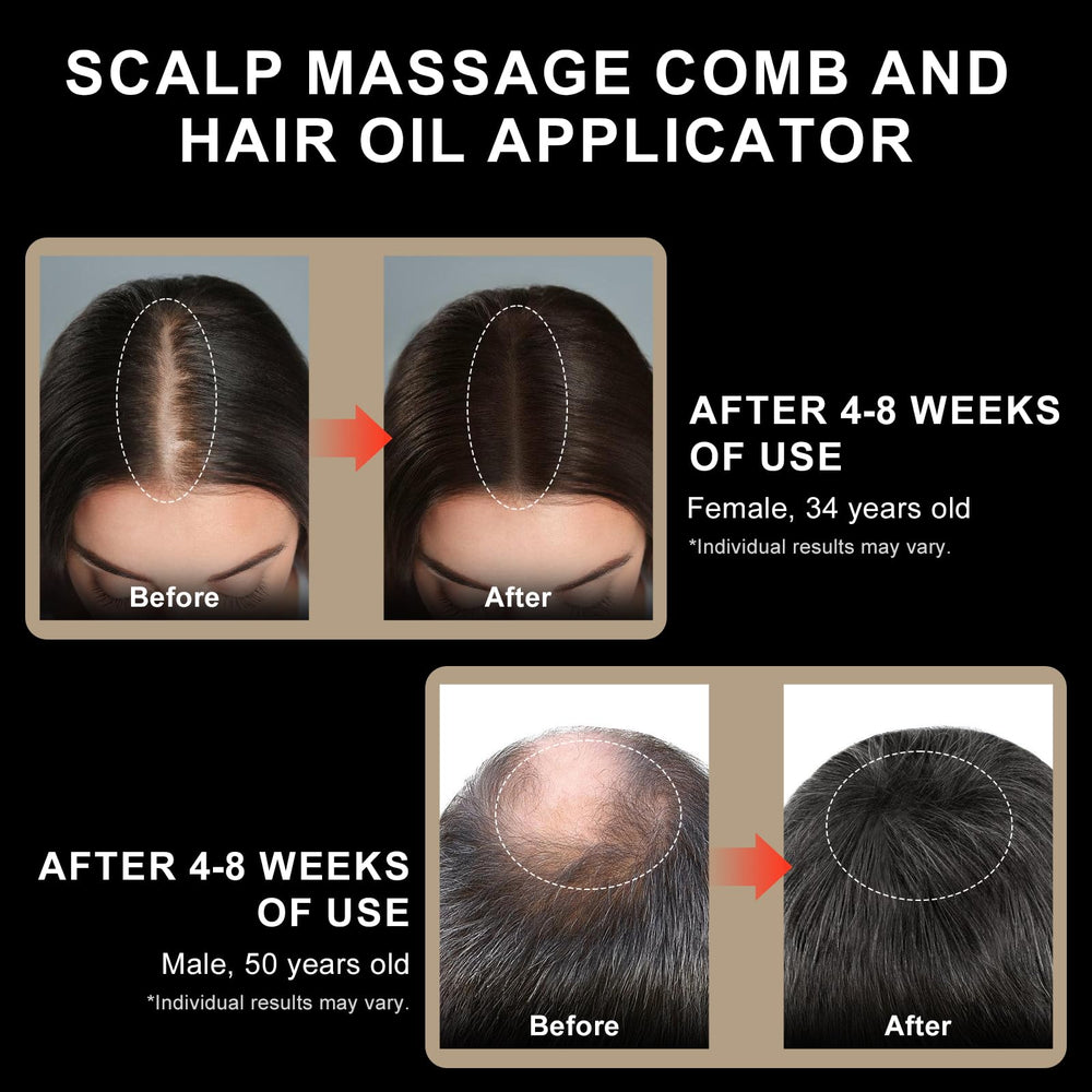 DongBlitz serum application feature optimizes absorption of minoxidil or oils.
