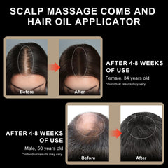 DongBlitz serum application feature optimizes absorption of minoxidil or oils.