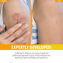 Dr. Robaina Arnica Roll-On close-up shows smooth, targeted application.