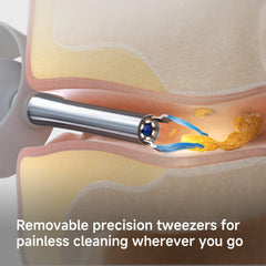 ECCLEUTH 6 LED lights illuminate the ear canal