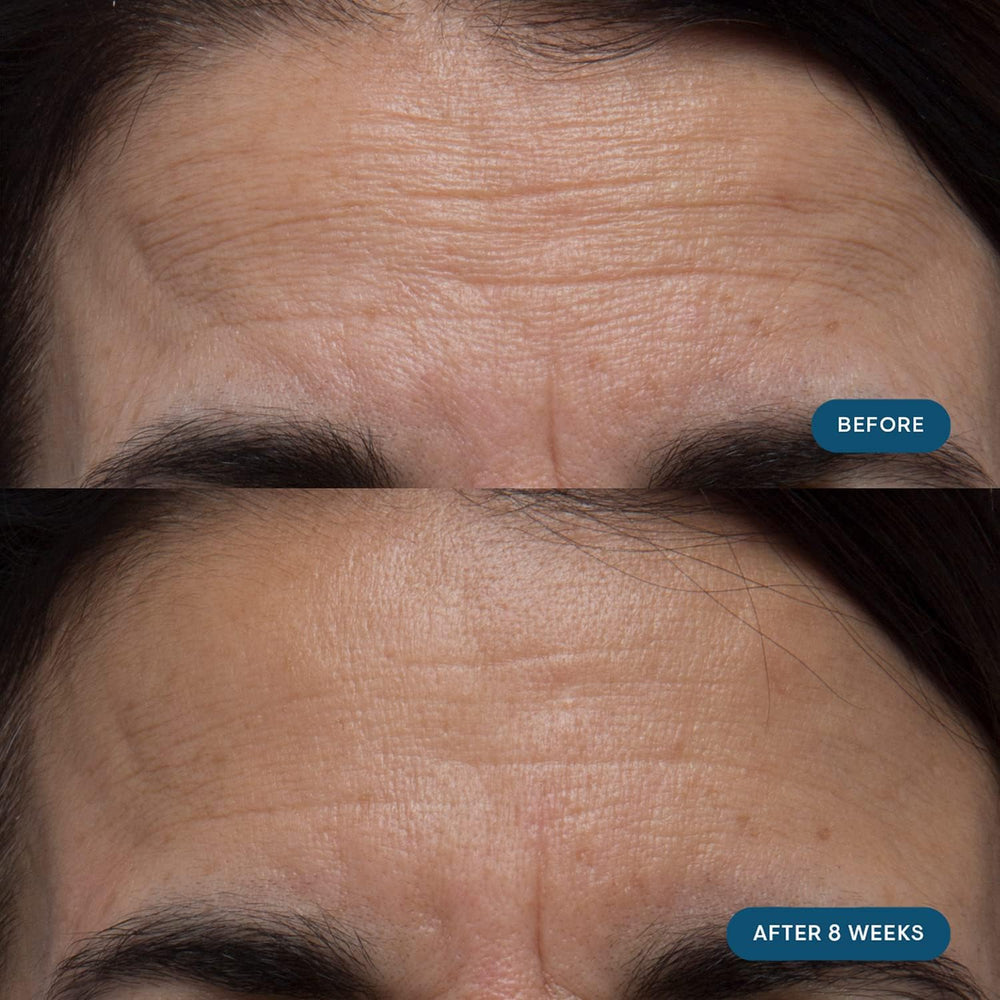 Elemis Pro-Collagen capsules ready for daily consumption.