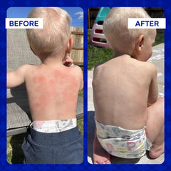 Family-friendly Emuaid Ointment suitable for all ages including infants.