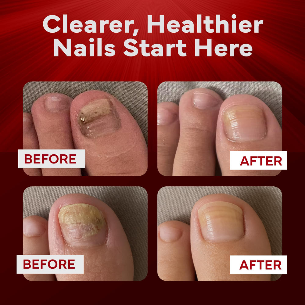 EMUAIDMAX clinically-inspired fungal care depiction emphasizes targeted nail health.