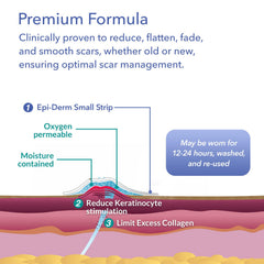 EpiDerm customizable flexible fit demonstrates trim-to-size capability.
