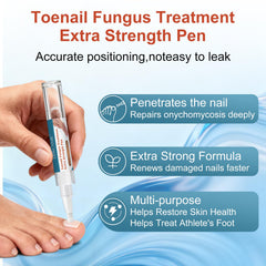 ERWCNMIE anti-fungal nail pen with 25% undecylenic acid for gentle care