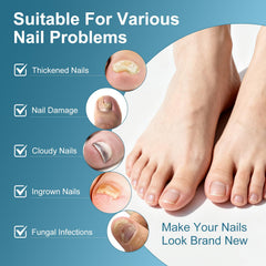 ERWCNMIE nail repair pen featuring a precision brush for targeted nail care