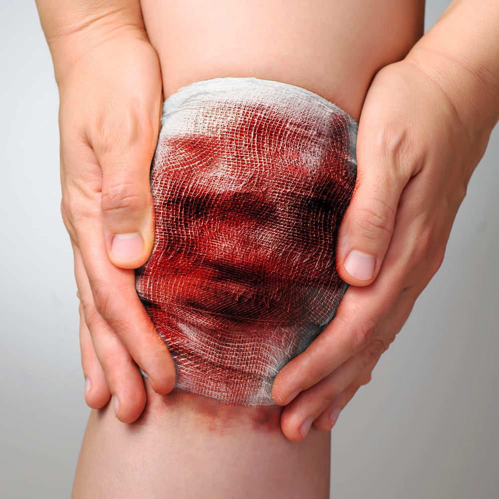Ever Ready First Aid gauze in use for rapid, controlled bleeding management