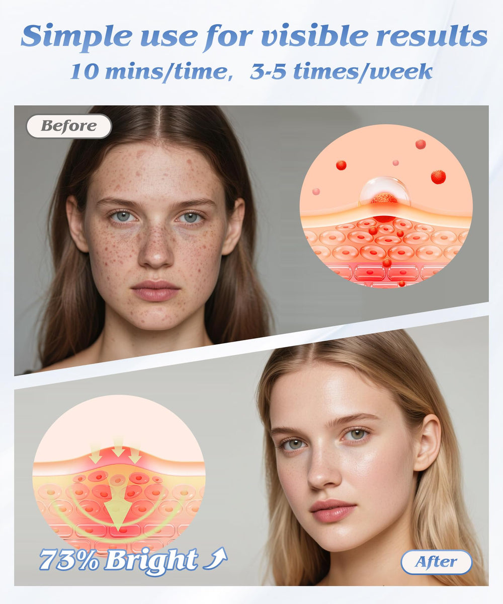 EVFOFO infrared light mode for soothing warmth and deeper skin care