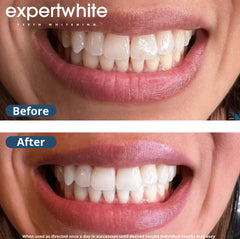 Enamel-safe Expertwhite formula for gentle whitening.