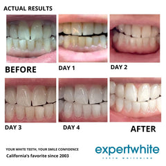 Made in USA enamel-friendly formula supports safe whitening.