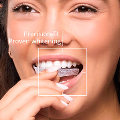 ExpertWhite Max Glow Trays saliva-activated gel visible on trays.