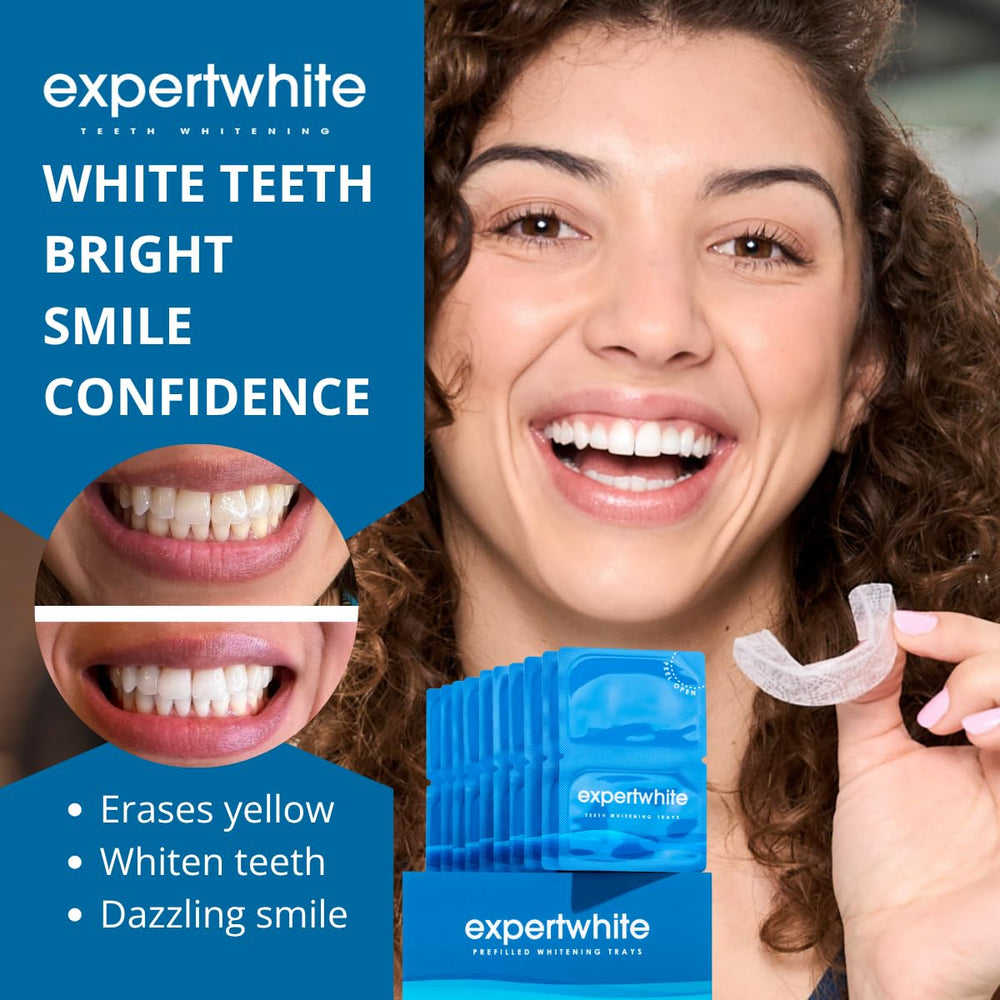 ExpertWhite Max Glow Trays top-teeth application showing precise fit.